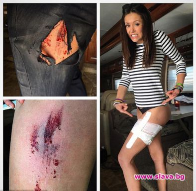 Нина Добрев претърпя инцидент по време на снимки