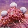 Трансплантирани имунни клетки се борят успешно с рака