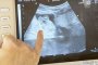 Бебетата се усмихват още в утробата на майката
