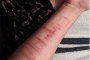     13-годишно момиче се самоуби заради играта Син кит 