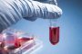  Кръвен тест може да засече рак години преди появата на симптоми