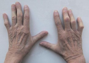 
И подчерта, че от организацията очакват улесняване на пътя на пациента. 