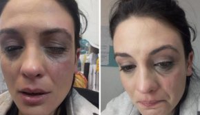 
Вергов в това време е извикан на разговор от продуцента Милошев. След това Милошев вика и Диана и я натиска да не подава сигнал в полицията.