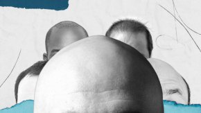 В живота на всеки плешив мъж има три важни дни: Денят, в който осъзнавате, че губите косата си, денят, в който осъзнавате, че трябва да обръснете това, което е останало, и денят, в който най-накрая го правите. Грациозното оплешивяване се състои в това да намалите максимално разликата между тези етапи. Научих това по трудния начин.