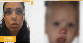 Мъжът блъснал детето ми с тротинетка твърди, че е получил диабет и шизофрения от самата случка: Майката