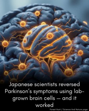 Японски учени обърнаха симптомите на Паркинсон с помощта на лабораторно отгледани мозъчни клетки