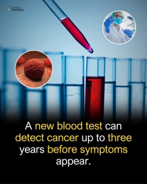 Тест открива рак 3 г. преди симптоми