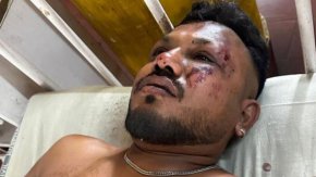 Чудо на седалка 11А: какво знаем за единствения оцелял в катастрофата на Air India Вишваш Кумар Рамеш