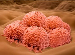  Генетично модифициран херпес вирус може скоро да бъде одобрен за лечение на рак на кожата