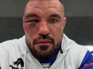 Валентинов се извини: Не съм разбрал, че отхапвам ухото на Митко