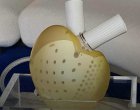 Вечно изкуствено сърце от Франция
