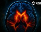 Мечтите тренират мозъка за добро: Изследване