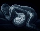 Дебелеем и на диета, ако не спим добре: Учените