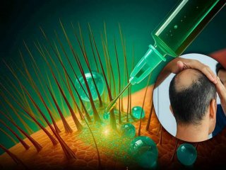 Учени от UCLA разработиха обещаваща молекула за възстановяване на косата