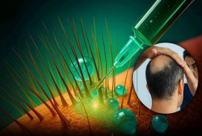 Учени от UCLA разработиха обещаваща молекула за възстановяване на косата