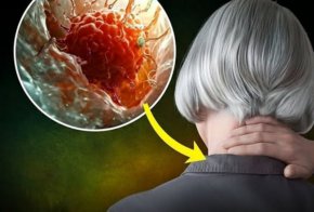 Побелялата коса може да бъде естествена защита срещу рак: Ново проучване