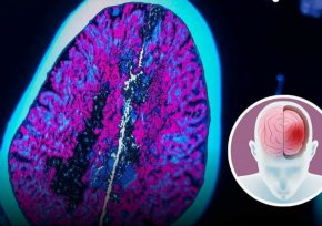 Мозъкът се самоизяжда без сън: Изследване