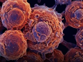 Диабет Тип 2 вече е обратим: Изследване     